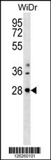 THAP10 Antibody (N-term) (Cat. #AP18325a) western blot analysis in WiDr cell line lysates (35ug/lane).This demonstrates the THAP10 Antibody detected the THAP10 protein (arrow).