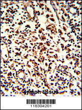 Formalin-fixed and paraffin-embedded human lymph with BARON Antibody (N-term), which was peroxidase-conjugated to the secondary antibody, followed by DAB staining. This data demonstrates the use of this antibody for immunohistochemistry; clinical relevance has not been evaluated.