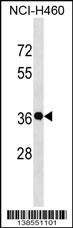 GSX2 Antibody (C-term) (Cat. #AP18311b) western blot analysis in NCI-H460 cell line lysates (35ug/lane).This demonstrates the GSX2 antibody detected the GSX2 protein (arrow).