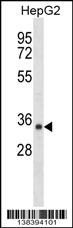 SDR39U1 Antibody (N-term) (Cat. #AP18301a) western blot analysis in HepG2 cell line lysates (35ug/lane).This demonstrates the SDR39U1 antibody detected the SDR39U1 protein (arrow).