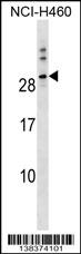 TTYH1 Antibody (N-term) (Cat. #AP18295a) western blot analysis in NCI-H460 cell line lysates (35ug/lane).This demonstrates the TTYH1 antibody detected the TTYH1 protein (arrow).