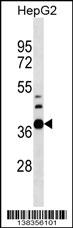 RPUSD1 Antibody (Center) (Cat. #AP18285c) western blot analysis in HepG2 cell line lysates (35ug/lane).This demonstrates the RPUSD1 antibody detected the RPUSD1 protein (arrow).