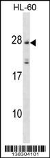 MS4A5 Antibody (N-term) (Cat. #AP18276a) western blot analysis in HL-60 cell line lysates (35ug/lane).This demonstrates the MS4A5 antibody detected the MS4A5 protein (arrow).