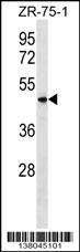 VN1R5 Antibody (Center) (Cat. #AP18258c) western blot analysis in ZR-75-1 cell line lysates (35ug/lane).This demonstrates the VN1R5 antibody detected the VN1R5 protein (arrow).