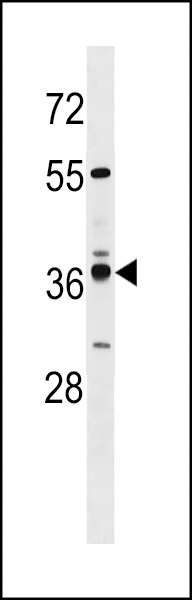 VN1R4 Antibody (Center) (Cat. #AP18257c) western blot analysis in MDA-MB231 cell line lysates (35ug/lane).This demonstrates the VN1R4 antibody detected the VN1R4 protein (arrow).