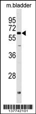 PGM2L1 Antibody (C-term) (Cat. #AP18243b) western blot analysis in mouse bladder tissue lysates (35ug/lane).This demonstrates the PGM2L1 antibody detected the PGM2L1 protein (arrow).