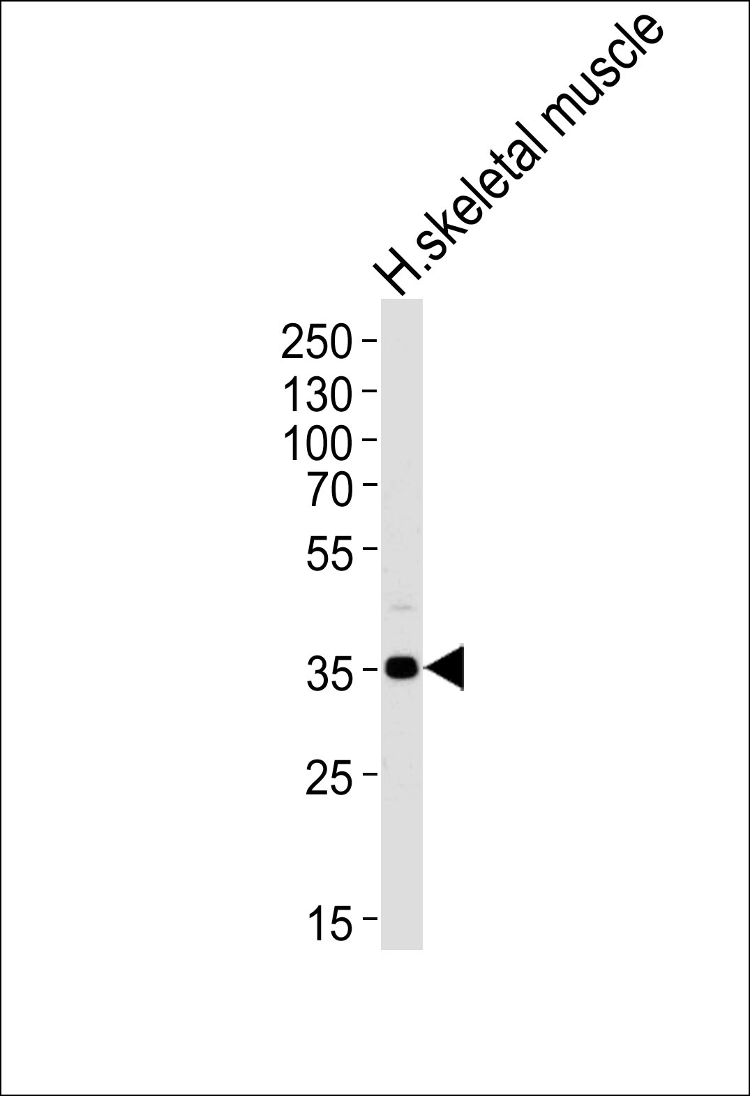 Western blot analysis of lysate from human skeletal muscle tissue lysate, using PPP1R3B Antibody (C-term)(Cat. #AP18235b). AP18235b was diluted at 1:1000 at each lane. A goat anti-rabbit IgG H&L(HRP) at 1:5000 dilution was used as the secondary antibody. Lysate at 35ug per lane.