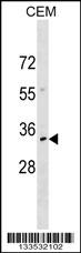 NKX2-6 Antibody (N-term) (Cat. #AP18223a) western blot analysis in CEM cell line lysates (35ug/lane).This demonstrates the NKX2-6 antibody detected the NKX2-6 protein (arrow).
