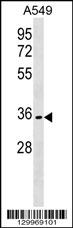 OR51B6 Antibody (C-term) (Cat. #AP18220b) western blot analysis in A549 cell line lysates (35ug/lane).This demonstrates the OR51B6 antibody detected the OR51B6 protein (arrow).