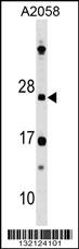 DRAP1 Antibody (N-term) (Cat. #AP18211a) western blot analysis in A2058 cell line lysates (35ug/lane).This demonstrates the DRAP1 antibody detected the DRAP1 protein (arrow).