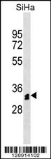 OR51M1 Antibody (N-term) (Cat. #AP18190a) western blot analysis in SiHa cell line lysates (35ug/lane).This demonstrates the OR51M1 antibody detected the OR51M1 protein (arrow).