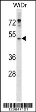 ENPP4 Antibody (Center) (Cat. #AP18179c) western blot analysis in WiDr cell line lysates (35ug/lane).This demonstrates the ENPP4 antibody detected the ENPP4 protein (arrow).