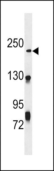 NHSL1 Antibody (Center) (Cat. #AP18178c) western blot analysis in CEM cell line lysates (35ug/lane).This demonstrates the NHSL1 antibody detected the NHSL1 protein (arrow).