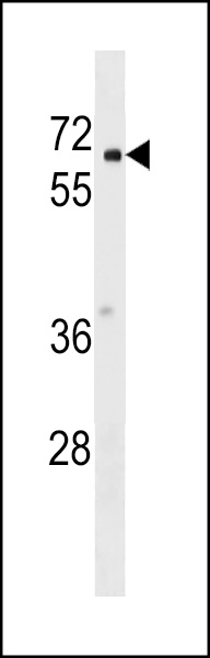 PYRD2 Antibody (N-term) (Cat. #AP18172a) western blot analysis in A2058 cell line lysates (35ug/lane).This demonstrates the PYRD2 antibody detected the PYRD2 protein (arrow).