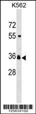 ORNT2 Antibody (Center) (Cat. #AP18166c) western blot analysis in K562 cell line lysates (35ug/lane).This demonstrates the ORNT2 antibody detected the ORNT2 protein (arrow).