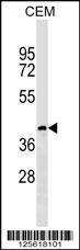 CC113 Antibody (C-term) (Cat. #AP18163b) western blot analysis in CEM cell line lysates (35ug/lane).This demonstrates the CC113 antibody detected the CC113 protein (arrow).
