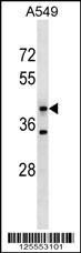 MFSD5 Antibody (C-term) (Cat. #AP18160b) western blot analysis in A549 cell line lysates (35ug/lane).This demonstrates the MFSD5 antibody detected the MFSD5 protein (arrow).