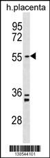 PAPD5 Antibody (N-term) (Cat. #AP18427a) western blot analysis in human placenta tissue lysates (35ug/lane).This demonstrates the PAPD5 Antibody detected the PAPD5 protein (arrow).