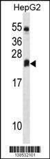DHRS4L2 Antibody (Center) (Cat. #AP18423c) western blot analysis in HepG2 cell line lysates (35ug/lane).This demonstrates the DHRS4L2 Antibody detected the DHRS4L2 protein (arrow).