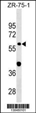 GDPD2 Antibody (Center) (Cat. #AP18406c) western blot analysis in ZR-75-1 cell line lysates (35ug/lane).This demonstrates the GDPD2 Antibody detected the GDPD2 protein (arrow).