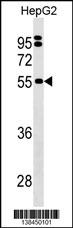 SEPSECS Antibody (C-term) (Cat. #AP18403b) western blot analysis in HepG2 cell line lysates (35ug/lane).This demonstrates the SEPSECS Antibody detected the SEPSECS protein (arrow).