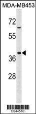 Mouse Hoxa9 Antibody (Center) (Cat. #AP18401c) western blot analysis in MDA-MB453 cell line lysates (35ug/lane).This demonstrates the Mouse Hoxa9 Antibody detected the Mouse Hoxa9 protein (arrow).