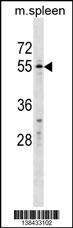 WFIKKN2 Antibody (C-term) (Cat. #AP18396b) western blot analysis in mouse spleen tissue lysates (35ug/lane).This demonstrates the WFIKKN2 Antibody detected the WFIKKN2 protein (arrow).