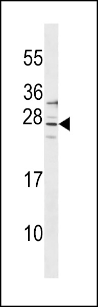 SIRPD Antibody (Center) (Cat. #AP18390c) western blot analysis in 293 cell line lysates (35ug/lane).This demonstrates the SIRPD Antibody detected the SIRPD protein (arrow).