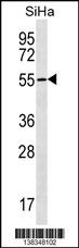RNF150 Antibody (N-term) (Cat. #AP18385a) western blot analysis in SiHa cell line lysates (35ug/lane).This demonstrates the RNF150 Antibody detected the RNF150 protein (arrow).