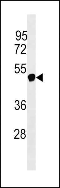 NXF5 Antibody (N-term) (Cat. #AP18378a) western blot analysis in Jurkat cell line lysates (35ug/lane).This demonstrates the NXF5 Antibody detected the NXF5 protein (arrow).