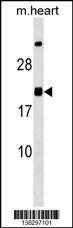 MED9 Antibody (C-term) (Cat. #AP18376b) western blot analysis in mouse heart tissue lysates (35ug/lane).This demonstrates the MED9 Antibody detected the MED9 protein (arrow).