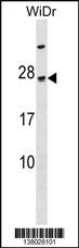 TGIF2LY Antibody (N-term) (Cat. #AP18370a) western blot analysis in WiDr cell line lysates (35ug/lane).This demonstrates the TGIF2LY Antibody detected the TGIF2LY protein (arrow).