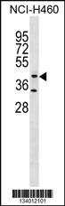 GLT8D1 Antibody (C-term) (Cat. #AP18349b) western blot analysis in NCI-H460 cell line lysates (35ug/lane).This demonstrates the GLT8D1 Antibody detected the GLT8D1 protein (arrow).