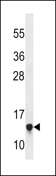 RPS23 Antibody (N-term) (Cat. #AP18598a) western blot analysis in Jurkat cell line lysates (35ug/lane).This demonstrates the RPS23 antibody detected the RPS23 protein (arrow).