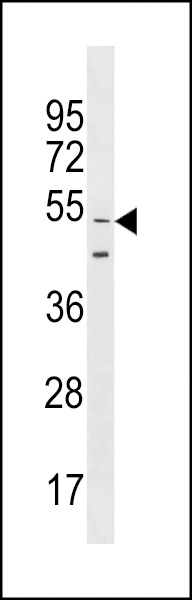 GOLGA6L9 Antibody (N-term) (Cat. #AP18553a) western blot analysis in CEM cell line lysates (35ug/lane).This demonstrates the GOLGA6L9 antibody detected the GOLGA6L9 protein (arrow).