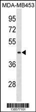 ALG8 Antibody (N-term) (Cat. #AP18533a) western blot analysis in MDA-MB453 cell line lysates (35ug/lane).This demonstrates the ALG8 antibody detected the ALG8 protein (arrow).