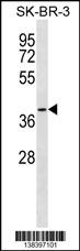 SFXN3 Antibody (C-term) (Cat. #AP18512b) western blot analysis in SK-BR-3 cell line lysates (35ug/lane).This demonstrates the SFXN3 antibody detected the SFXN3 protein (arrow).