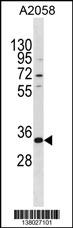 TGIF2LX Antibody (Center) (Cat. #AP18495c) western blot analysis in A2058 cell line lysates (35ug/lane).This demonstrates the TGIF2LX antibody detected the TGIF2LX protein (arrow).