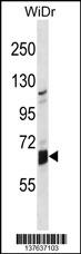 GLB1L Antibody (N-term) (Cat. #AP18487a) western blot analysis in WiDr cell line lysates (35ug/lane).This demonstrates the GLB1L antibody detected the GLB1L protein (arrow).