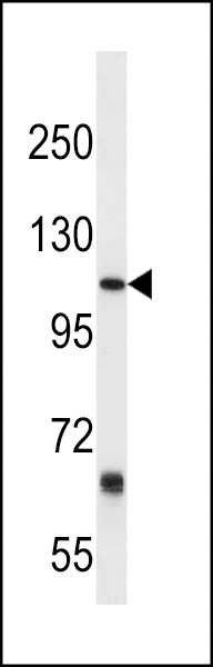 PTGFRN Antibody (Center) (Cat. #AP18481c) western blot analysis in mouse kidney tissue lysates (35ug/lane).This demonstrates the PTGFRN antibody detected the PTGFRN protein (arrow).