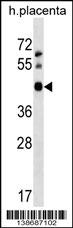 APOBEC3D Antibody (N-term)(Cat. #AP18763a) western blot analysis in human placenta tissue lysates (35ug/lane).This demonstrates the APOBEC3D antibody detected the APOBEC3D protein (arrow).