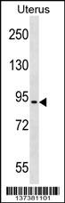 ASTE1 Antibody (N-term)(Cat. #AP18741a) western blot analysis in Uterus tissue lysates (35ug/lane).This demonstrates the ASTE1 antibody detected the ASTE1 protein (arrow).