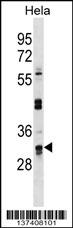 UTP11L Antibody (C-term) (Cat. #AP18665b) western blot analysis in Hela cell line lysates (35ug/lane).This demonstrates the UTP11L antibody detected the UTP11L protein (arrow).