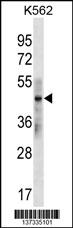 KRT33B Antibody (N-term) (Cat. #AP18642a) western blot analysis in K562 cell line lysates (35ug/lane).This demonstrates the KRT33B antibody detected the KRT33B protein (arrow).