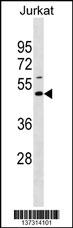 EAF1 Antibody (Center) (Cat. #AP18636c) western blot analysis in Jurkat cell line lysates (35ug/lane).This demonstrates the EAF1 antibody detected the EAF1 protein (arrow).