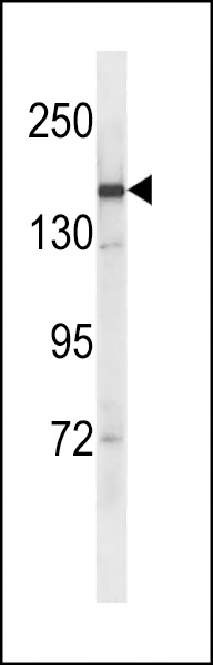 SYCP2 Antibody (C-term) (Cat. #AP18626b) western blot analysis in NCI-H292 cell line lysates (35ug/lane).This demonstrates the SYCP2 antibody detected the SYCP2 protein (arrow).