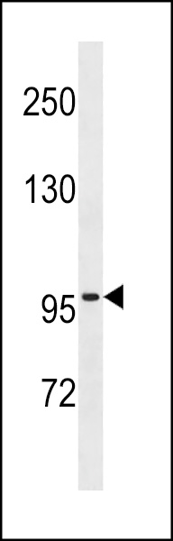 ZNF229 Antibody (N-term) (Cat. #AP18989a) western blot analysis in NCI-H292 cell line lysates (35ug/lane).This demonstrates the ZNF229 antibody detected the ZNF229 protein (arrow).