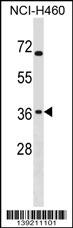 ST6GALNAC4 Antibody (C-term) (Cat. #AP18979b) western blot analysis in NCI-H460 cell line lysates (35ug/lane).This demonstrates the ST6GALNAC4 antibody detected the ST6GALNAC4 protein (arrow).