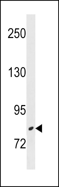 ZBTB17 Antibody (N-term) (Cat. #AP18958a) western blot analysis in NCI-H460 cell line lysates (35ug/lane).This demonstrates the ZBTB17 antibody detected the ZBTB17 protein (arrow).