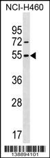MIER1 Antibody (Center) (Cat. #AP18957c) western blot analysis in NCI-H460 cell line lysates (35ug/lane).This demonstrates the MIER1 antibody detected the MIER1 protein (arrow).